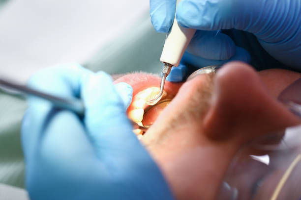 Best Mobile Emergency Dentist in Foxfire, NC